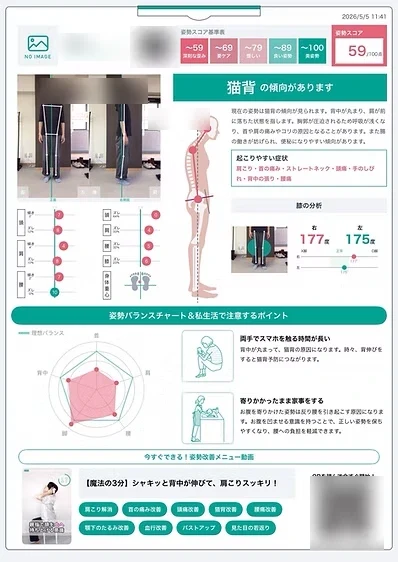 AI姿勢分析レポートの例